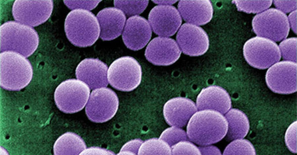 staphylococcus aureus visa 2 web