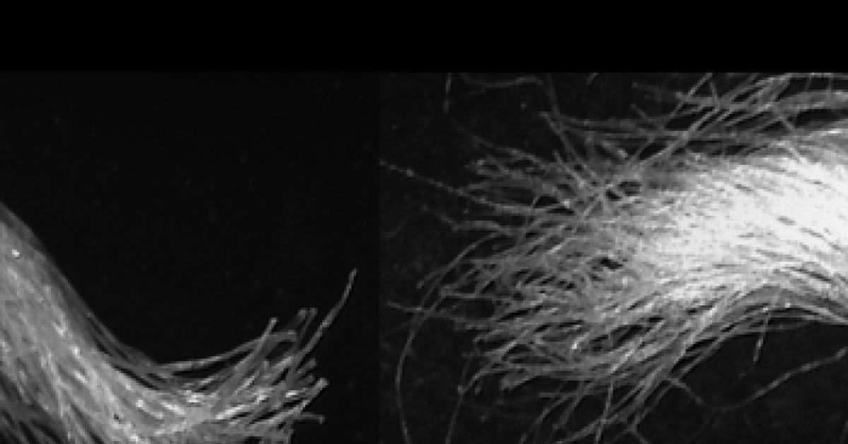 alkaline damaged fabric