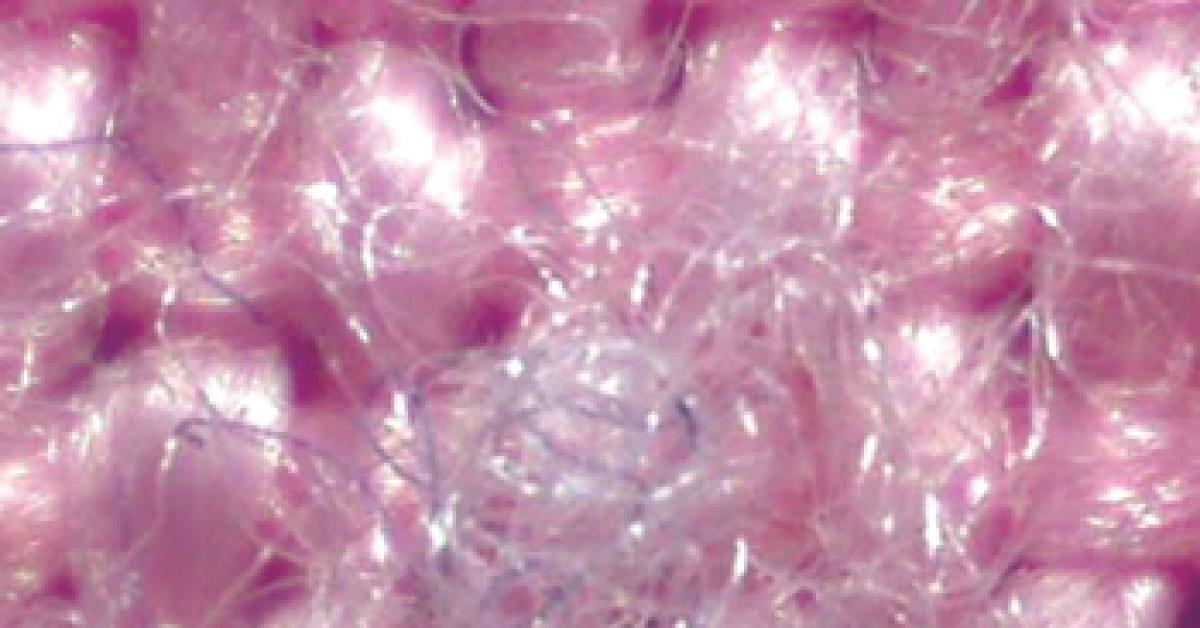 Troubleshooting Textiles What Causes Pilling? Redeposition? Shrinkage