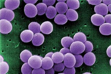 staphylococcus aureus visa 2 web